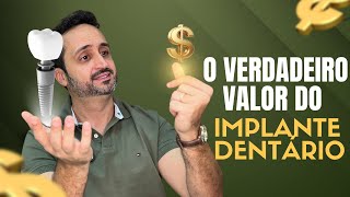 QUANTO CUSTA UM IMPLANTE DENTÁRIO? Tudo o que você precisa saber!