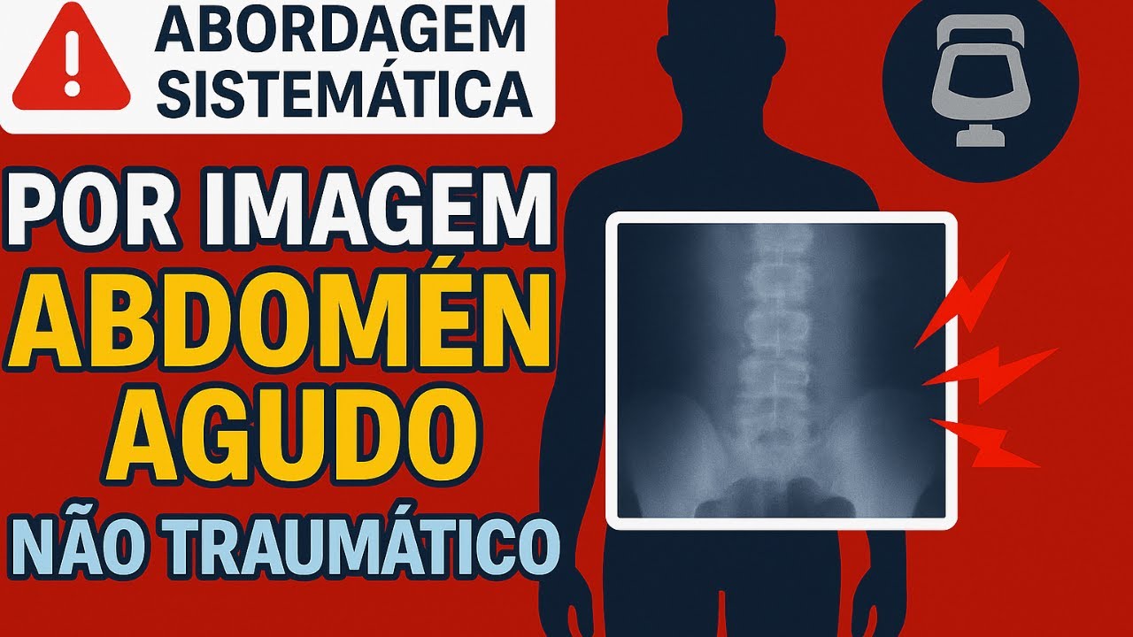 Canal Teórico :Abordagem sistemática por imagem do abdomen agudo não Traumático