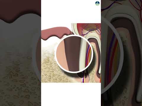 Sensitive teeth? This can be the reason.