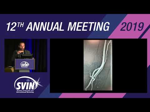 SVIN 2019: Complications and Bail out Strategies for Transradial Neurointervention
