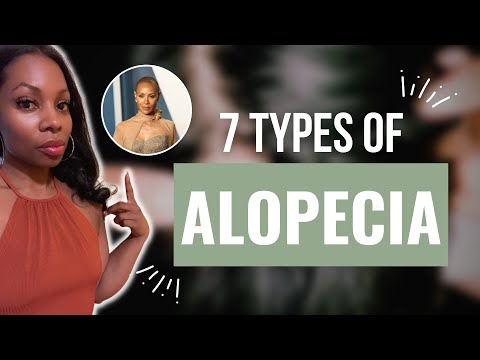 The Different Types of Alopecia: What You Need to Know! (Watch This for More Information!)