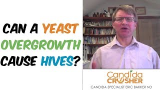 Can A Yeast Overgrowth Cause Hives?