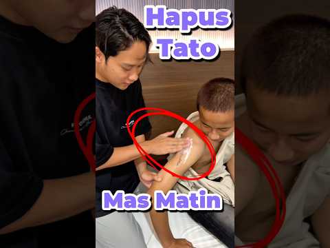 Hapus tato mas Matin #davidsunairi #anakdesa #minivlog #tato