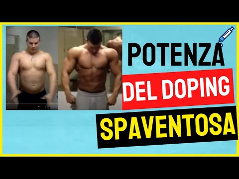 Effetto benzonal sulla potenza Operazioni prezzo denervazione sul glande