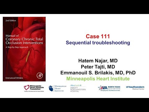 Case 111: Manual of CTO Interventions: Radial spasm and sequential troubleshooting