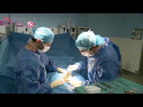 download lagu mp3 mp4 Enlever Un Kyste Testiculaire, download lagu Enlever Un Kyste Testiculaire gratis, unduh video klip Enlever Un Kyste Testiculaire