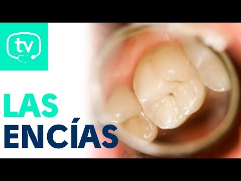 Las encías, las grandes olvidadas