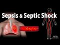 Sepsis and Septic Shock, Animation.