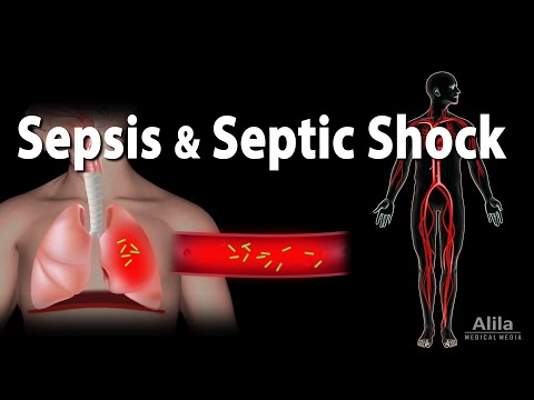 Sepsis and Septic Shock, Animation.