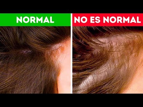 Descubre Lo Que Tu Cabello Puede Decirte Sobre Tu Salud