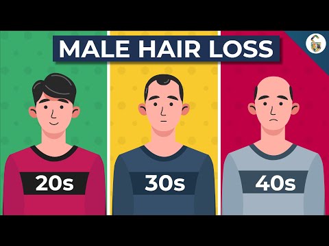 Going Bald? This Could Be Why...