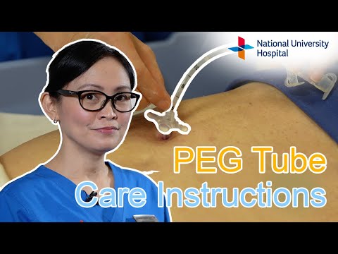PEG Tube Care Instructions