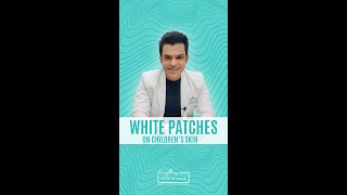 Download lagu White Patches on Children's Skin mp3
