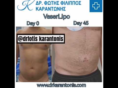 23 Νοεμβρίου 2022