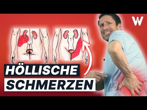 Nierensteine & Koliken stoppen: Typische Ursachen und 5 Tipps für Deine Nierengesundheit