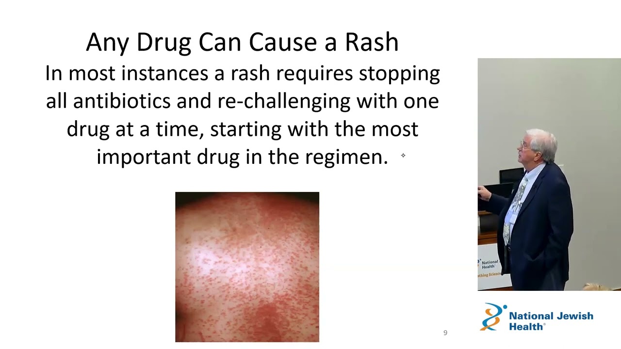 Management of Side Effects/Toxicity