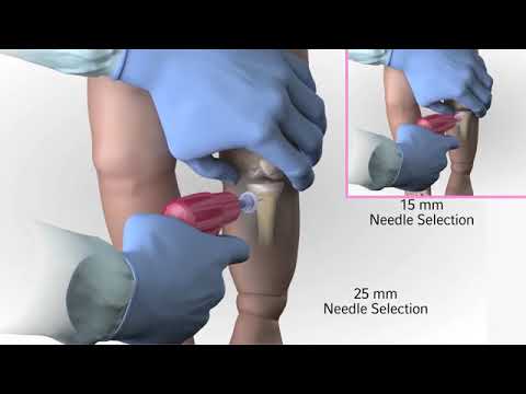 Arrow® EZ IO® Infant Child Needle Selection and Insertion Technique Animation Video