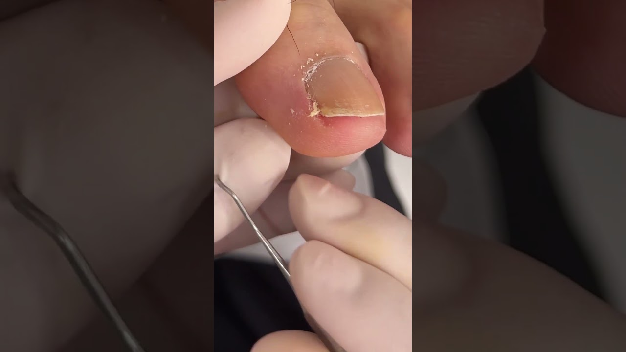 【爪の掃除】#shorts