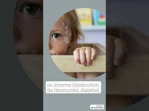 Vidéo : mycose de la peau expliquée par le dermatologue