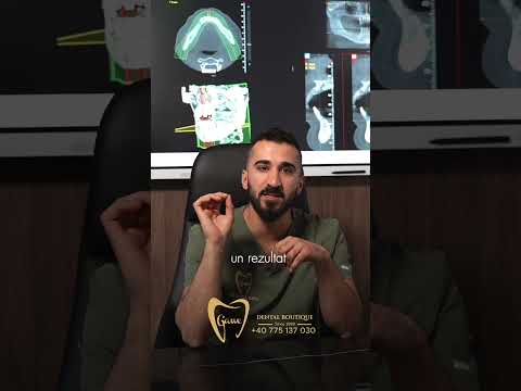 Rezultatul final este un echilibru perfect între estetică și funcționalitate