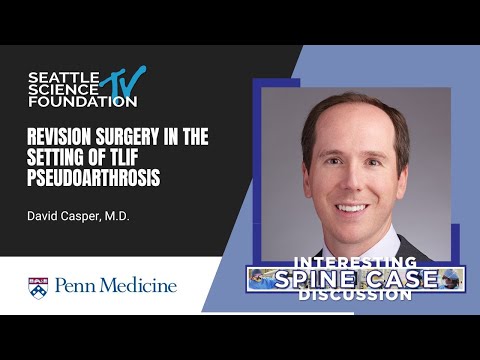 Revision Surgery in the Setting of TLIF Pseudoarthrosis - David Casper, MD