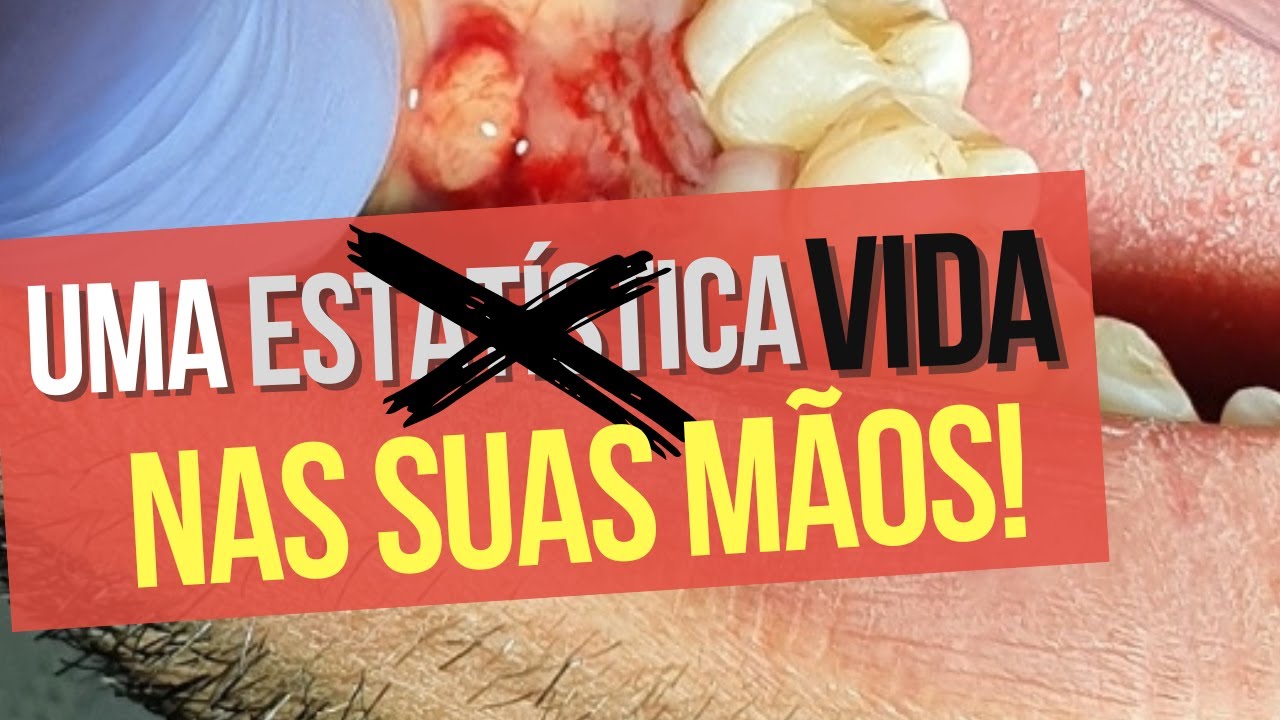 thumbnail video youtube