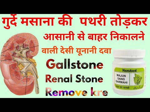 125 gms shahi majun sang sarmahi, for kidney stone