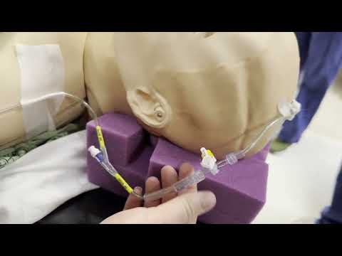 External Ventricular Drains (EVD) in the Cath Lab