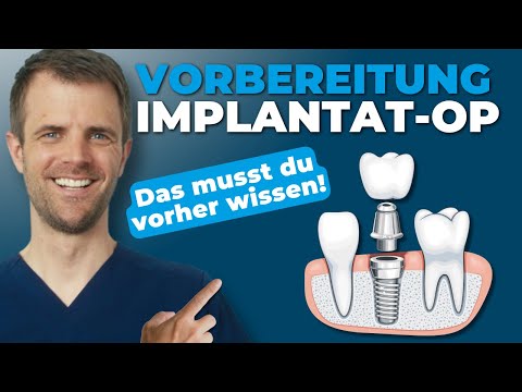 Vorbereitung auf deine Implantat-OP: Was Du vorher wissen und tun solltest!