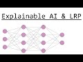 Explainable AI Layer Wise Relevance Propagation