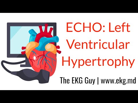 Left ventricular hypertrophy - ECHO Course l The EKG Guy video