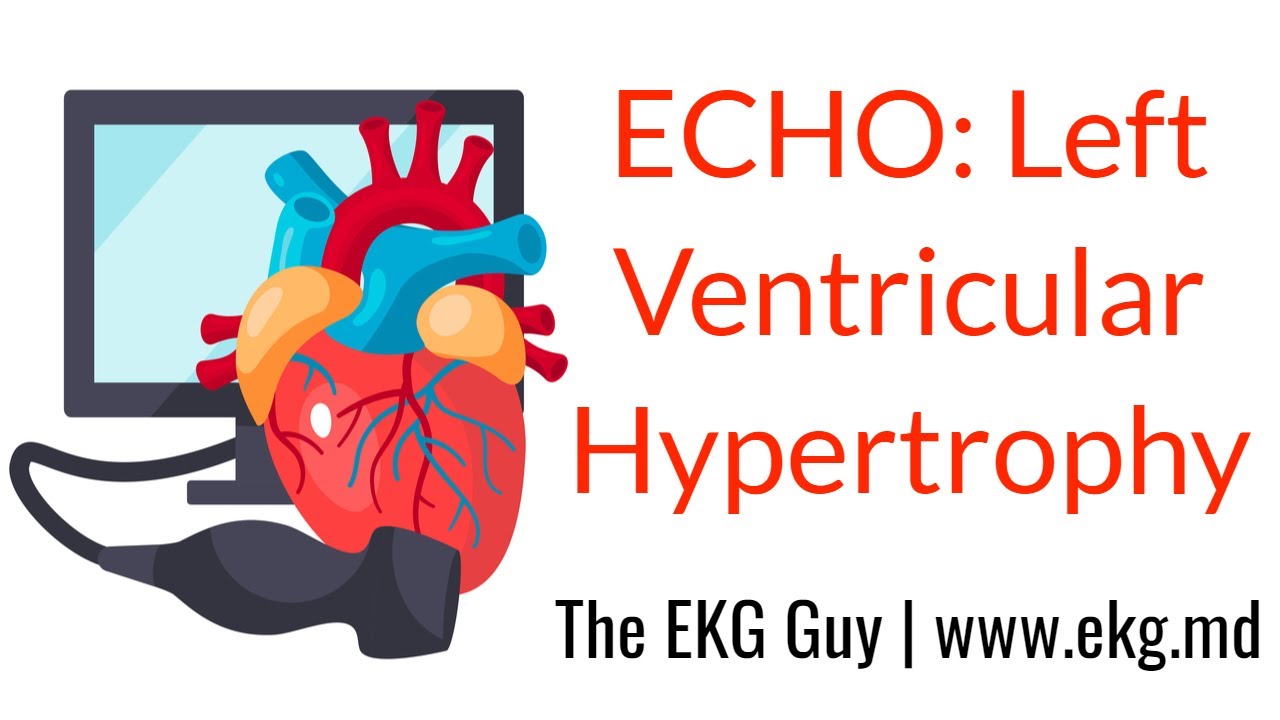 Left ventricular hypertrophy - ECHO Course l The EKG Guy video