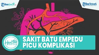 Waspadai Penderita Batu Empedu Dapat Memicu Komplikasi, Simak Ulasan dr  Hasan Maulahela