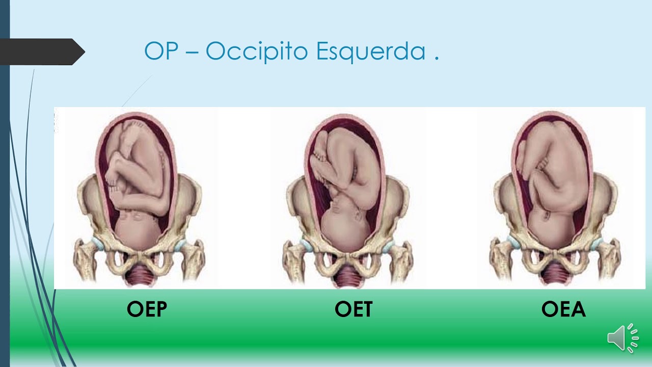 Variedade de posição 1o video