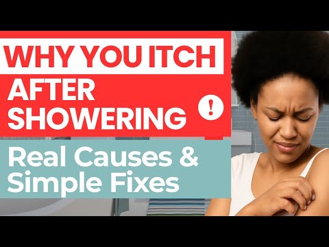 WHAT TO DO TO STOP ITCHING AFTER BATH- THE COMMON CAUSES AND HOW YOU CAN STOP THIS