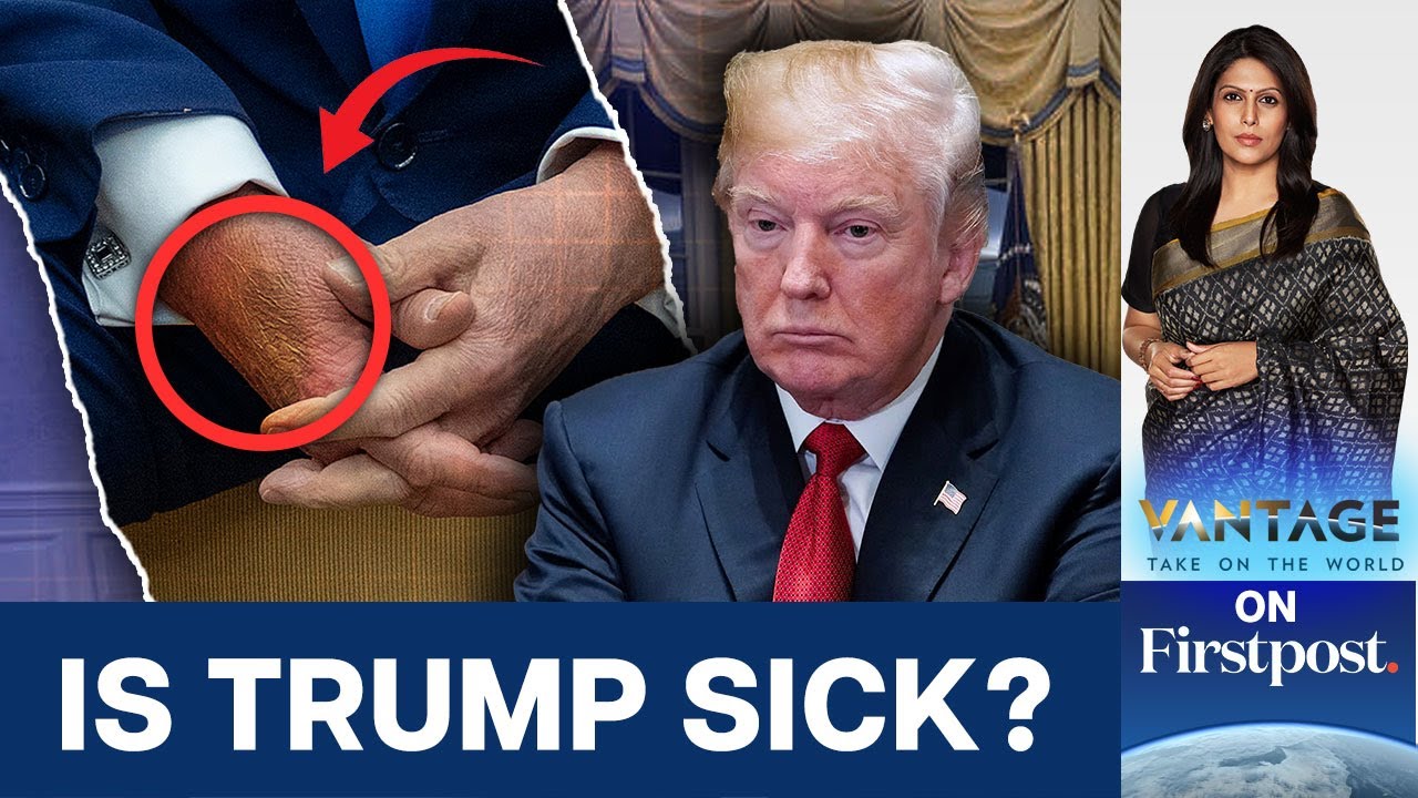 Mysterious Bruise Appears on Trump's ​Hand. Where Did it Come From? | Vantage with Palki Sharma