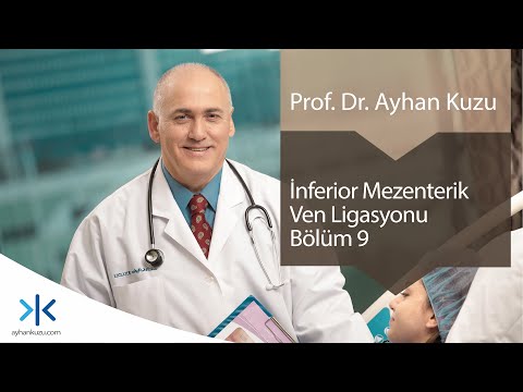 İnferior Mezenterik Ven Ligasyonu: Bölüm 9