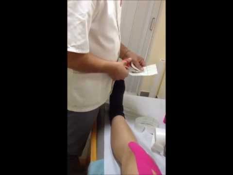 Perché scricchiolii dopo artroplastica Succo di osteocondrosi