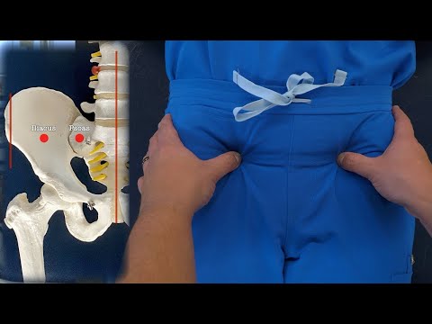 OMT: Counterstrain - Psoas Major; Iliacus Tender Points (Anterior Pelvis)