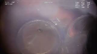 VIPER　Y字管挿入　∮100