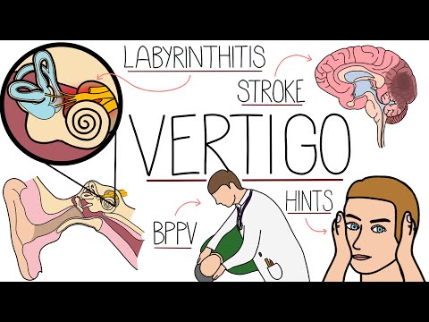 Vertigo Made Easy - Causes, Symptoms and Treatment