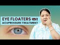 आंखों के सामने तैरते हुए धब्बों Eye Floaters क