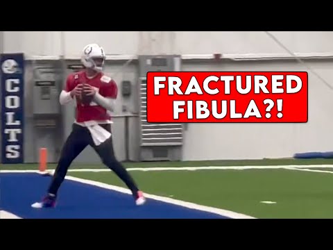 Daniel Jones Broke His Fibula and Wants to Play Through the Pain - Doctor Explains