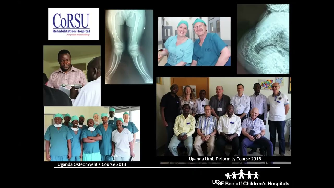 22: Developing a Pediatric Orthopedic Fellowship in Uganda | Coleen S. Sabatini, MD, MPH
