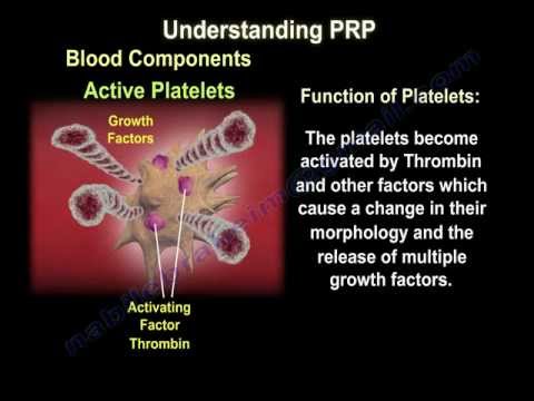 Platelet Rich Plasma Therapy - Everything You Need To Know - Dr. Nabil Ebraheim