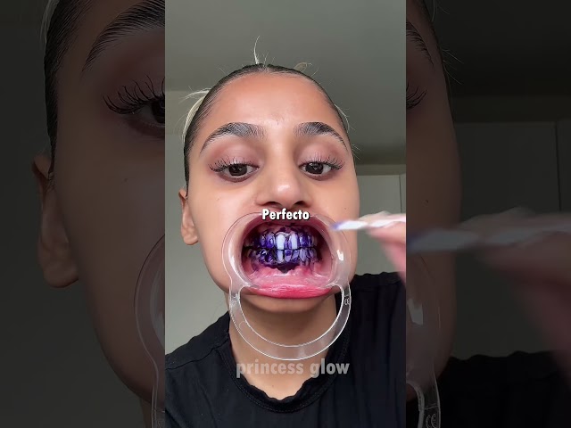 Vídeo relacionado con Hismile Tooth Armour Pasta de dientes sin flúor con suero, nano-hidroxiapatita, adecuada para dientes sensibles, fortalece el esmalte, con niacinamida, protección avanzada del esmalte