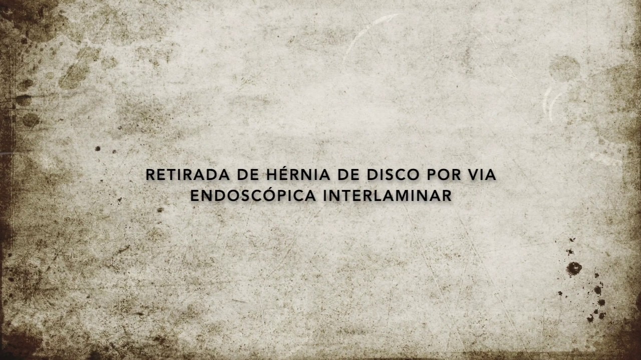 Mateus Tomaz Augusto-31