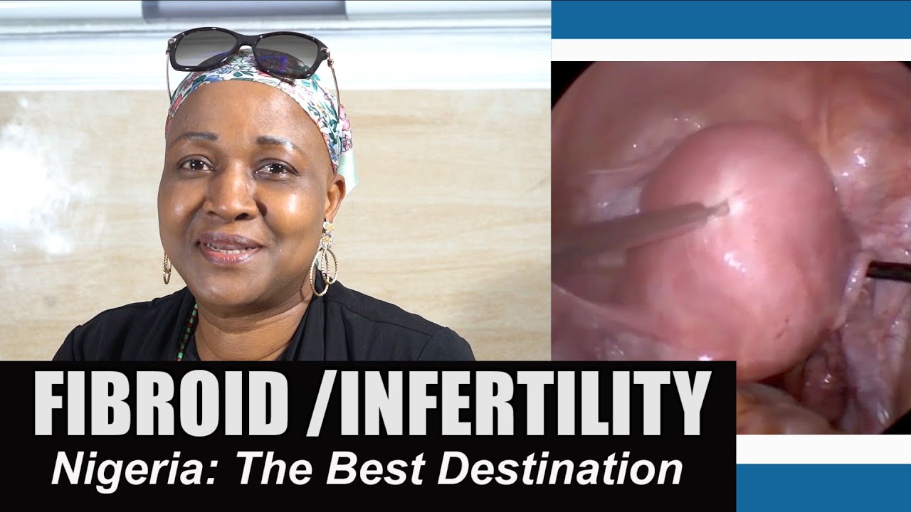 Fibroid/Infertility: Nigeria the best destination thumbnail