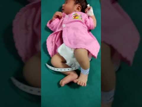 Newborn With Abnormal Movement