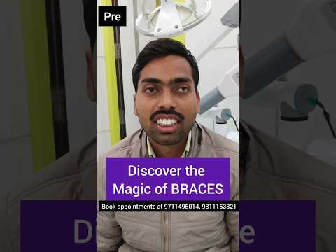 Discover the MAGIC of Braces! Dr. Srishti Bhatia #braces #teeth #orthodontist